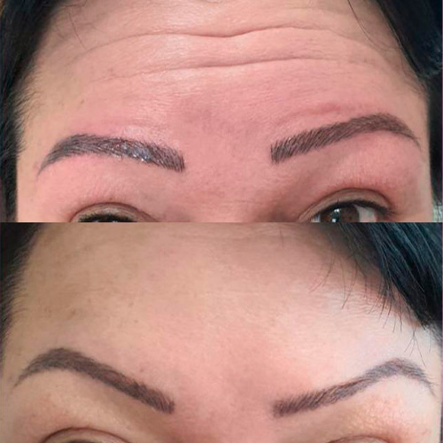 Resultado de tratamento 5