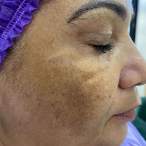 Guia para evitar intercorrências